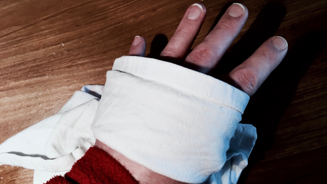 wounded_hand_bandage